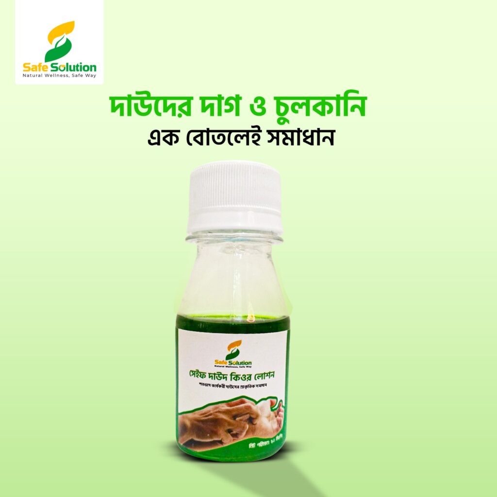 সেইফ দাউদ কিউর লোশন – প্রাকৃতিক দাউদ প্রতিকার