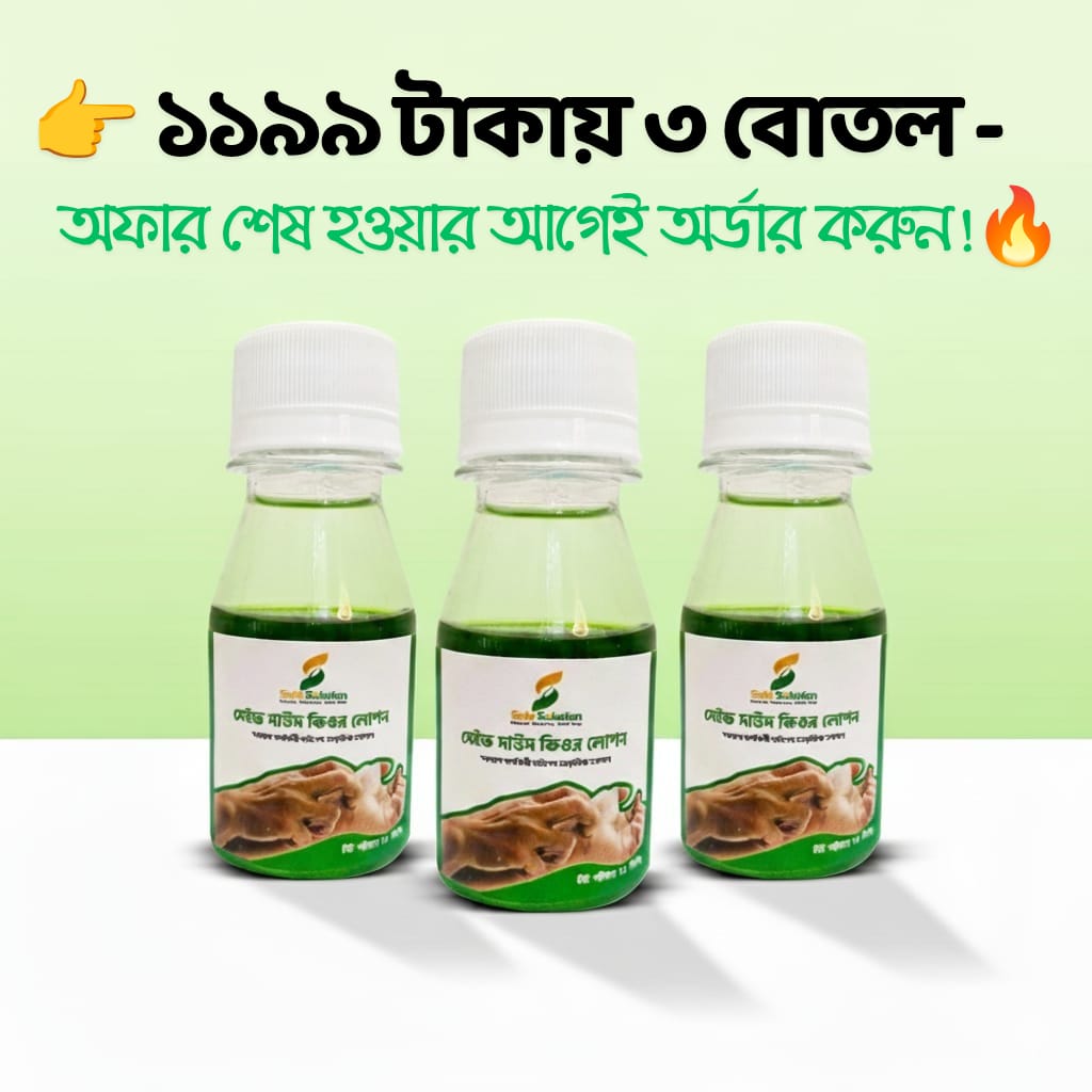সেইফ দাউদ কিউর লোশন – প্রাকৃতিক দাউদ প্রতিকার